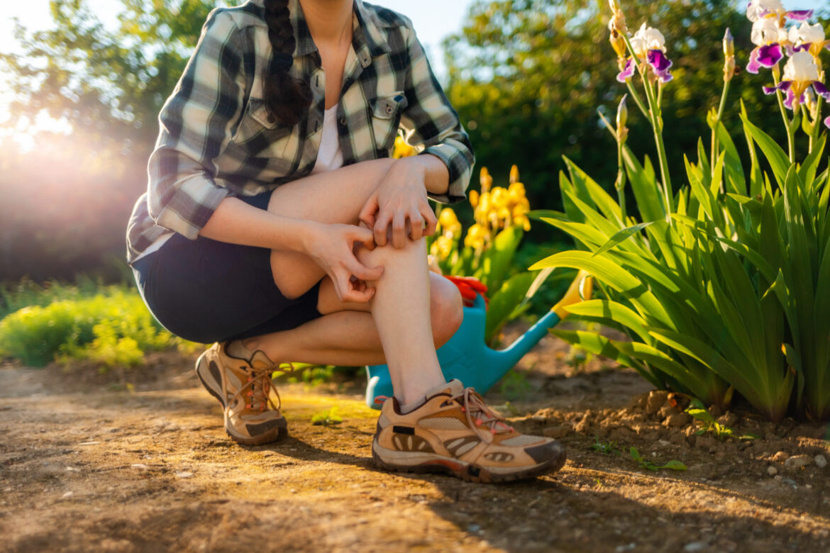 woman scratching her leg due to bug bites